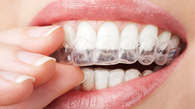 Tratamientos odontológicos: descubre innovaciones